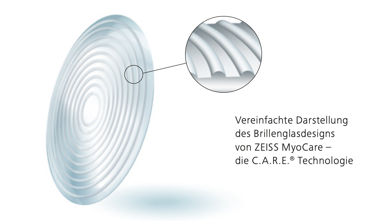 Zeissmyocare Brillenglaser